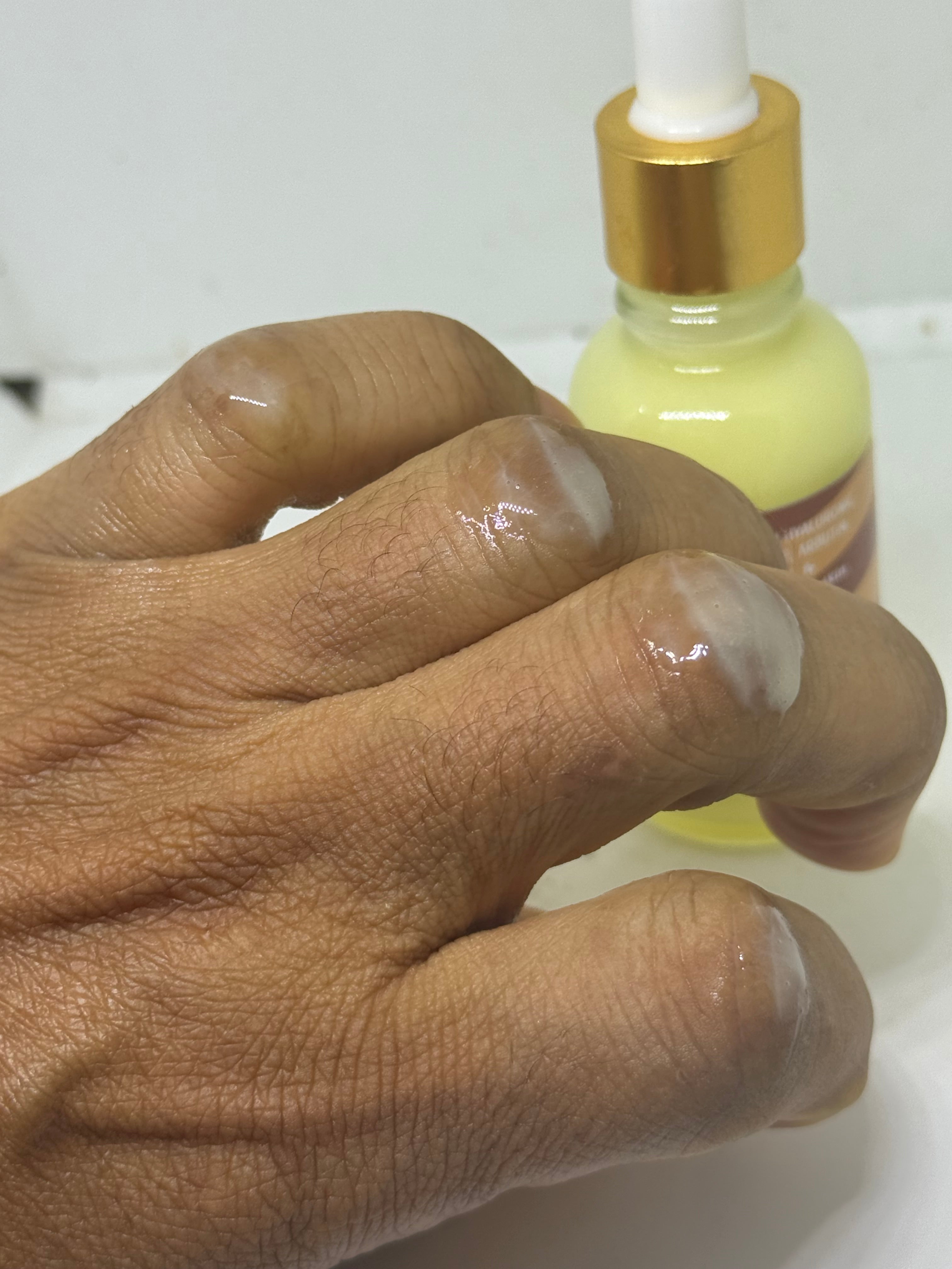 TTONE Dark Knuckle - Hand Cream and Brightening Serum 30ml