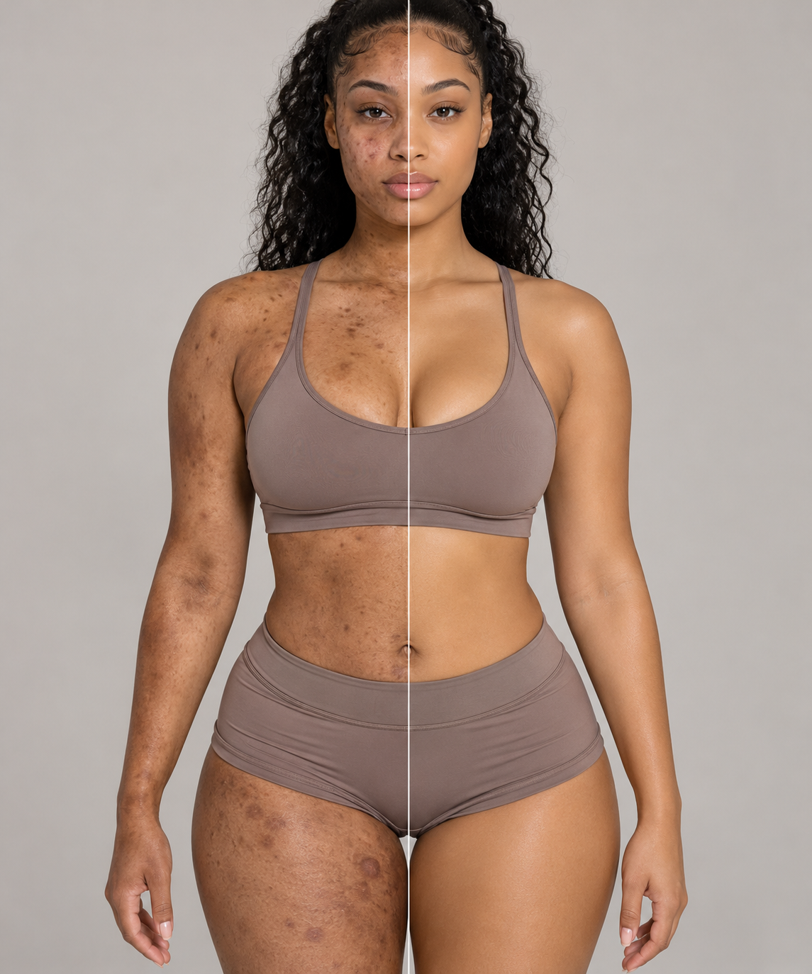 Before and after skin portrait. The left side shows dark spots and uneven tone, the right side shows clear skin.
